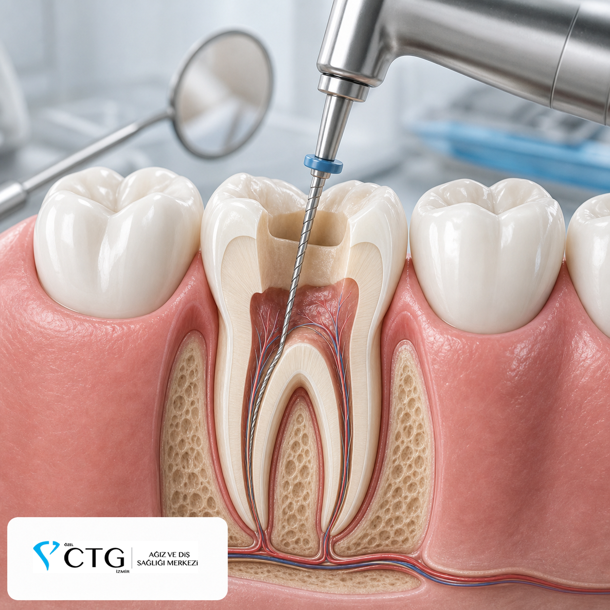 Endodonti